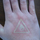 Illustration for article titled Guy Uses Laser-Etch Machine to Tattoo Himself (Verdict: Flaming Nutcase)